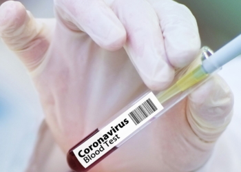 Vaccino Coronavirus Albania