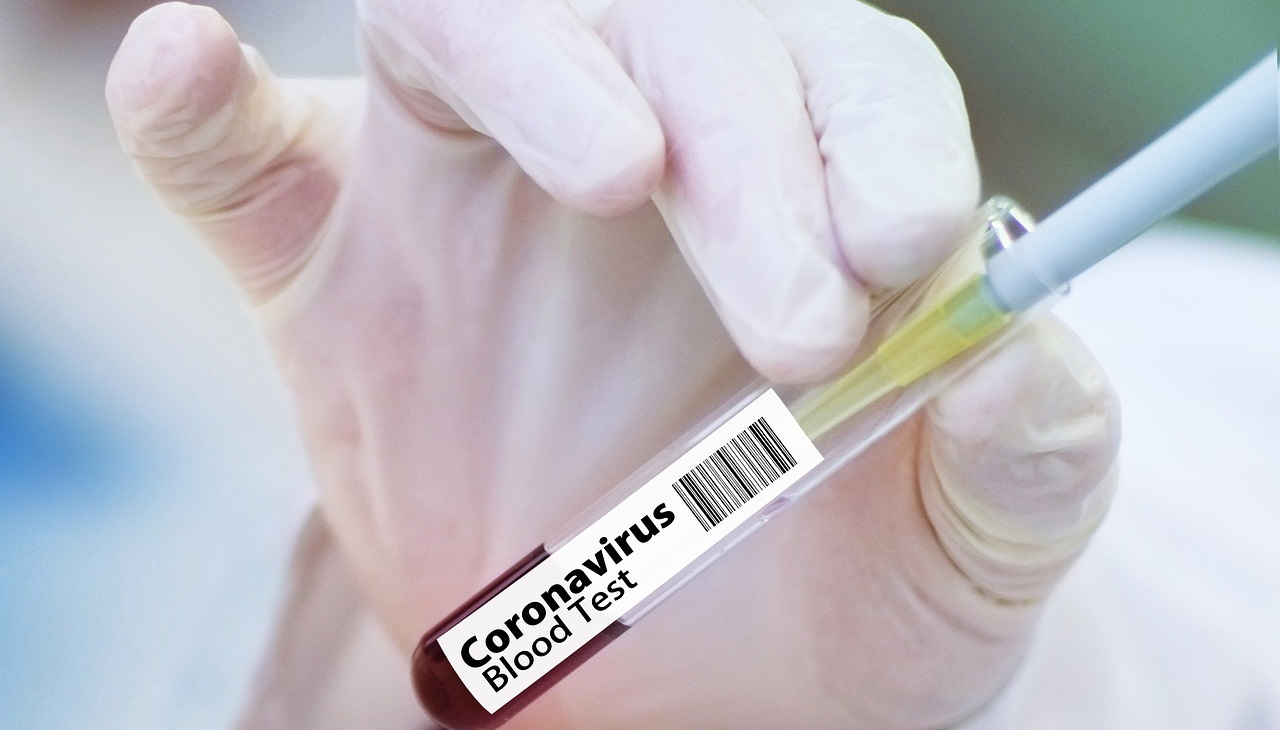 Vaccino Coronavirus Albania